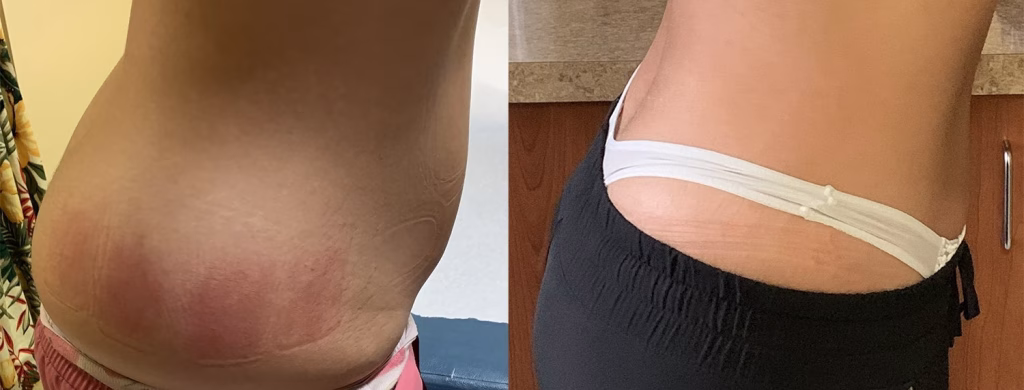 Evolve X Results