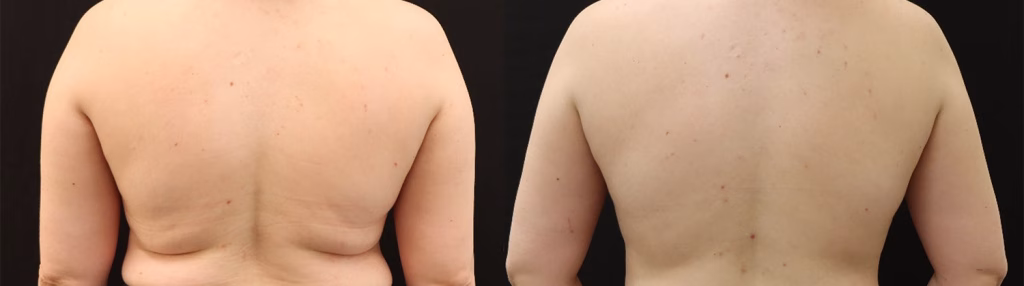 Evolve X Results